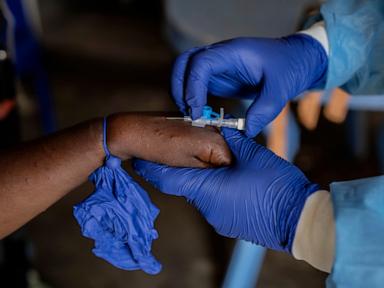 The UN authorizes the 1st mpox vaccine for children in an attempt to control the outbreak in Congo