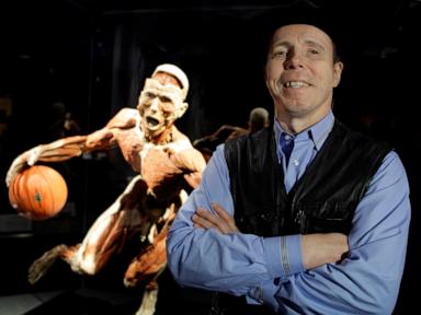 Why Gunther Von Hagens Changed How We Look At Death Forever