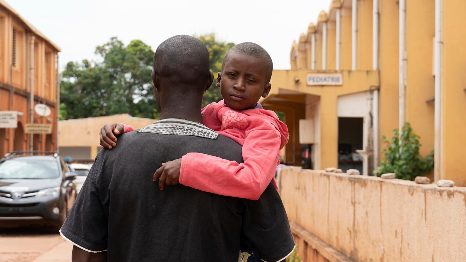 Burkina Faso's only eye doctor for children sees the trauma of both play and conflict