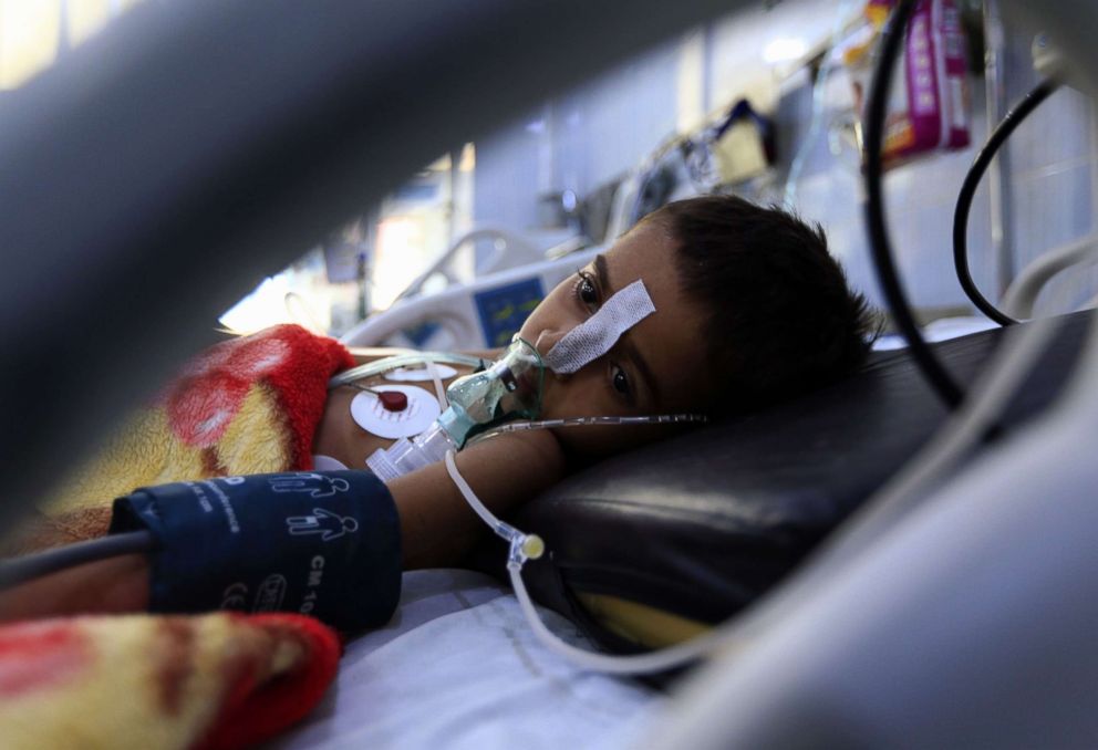 PHOTO: A Yemeni child suffering from a diphtheria infection receives treatment at a hospital in the capital Sanaa, Oct. 31, 2018.