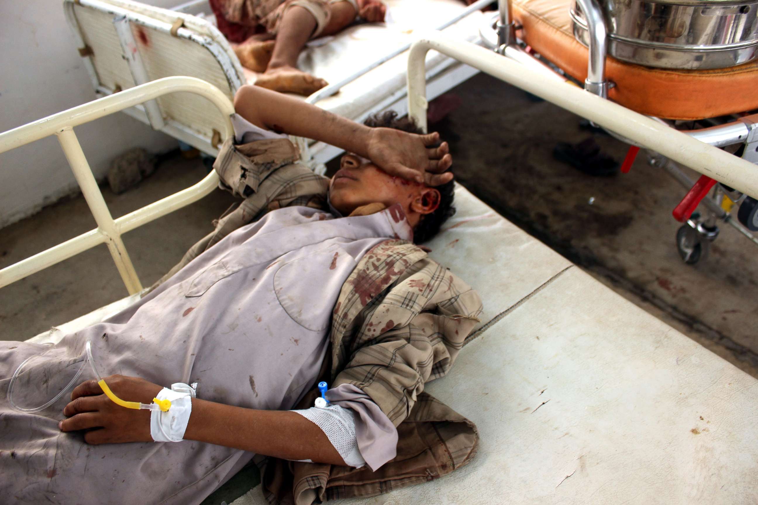 PHOTO: Wounded Yemeni children lay on a bed receiving treatment at a hospital after being injured in an alleged Saudi-led airstrike in the northern province of Saada, Yemen, Aug. 9, 2018.