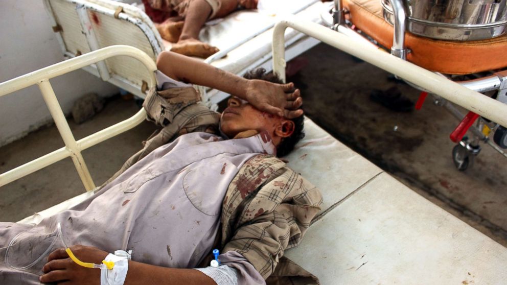 PHOTO: Wounded Yemeni children lay on a bed receiving treatment at a hospital after being injured in an alleged Saudi-led airstrike in the northern province of Saada, Yemen, Aug. 9, 2018.
