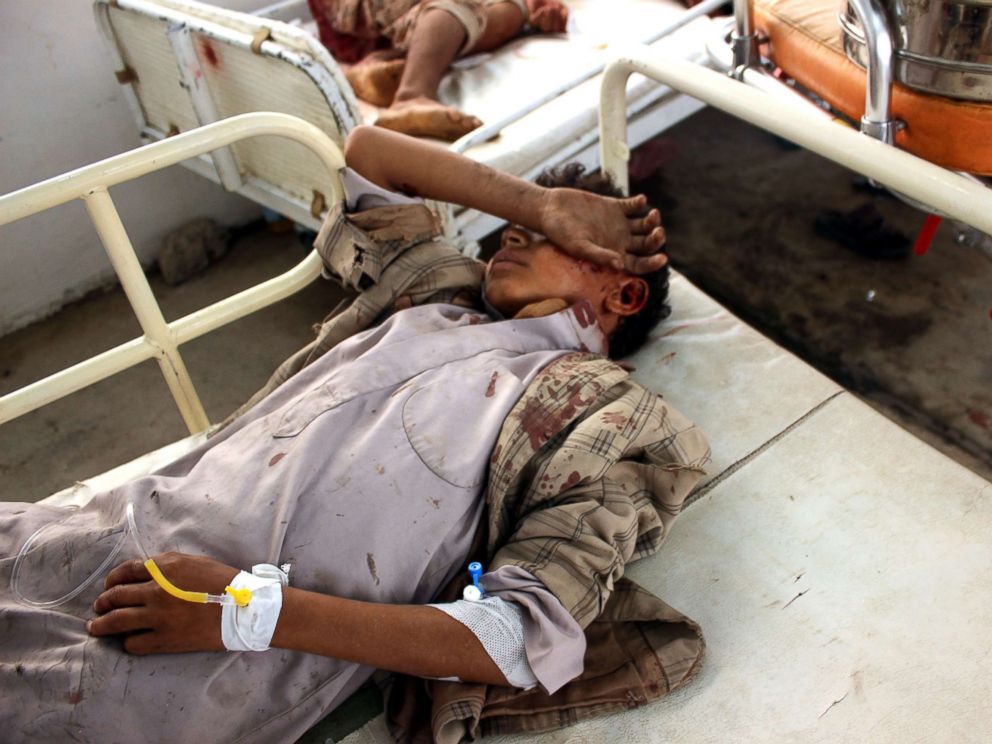 PHOTO: Wounded Yemeni children lay on a bed receiving treatment at a hospital after being injured in an alleged Saudi-led airstrike in the northern province of Saada, Yemen, Aug. 9, 2018.