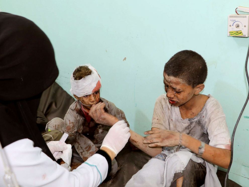 PHOTO: A doctor treats children injured by an airstrike in Saada, Yemen Aug. 9, 2018.