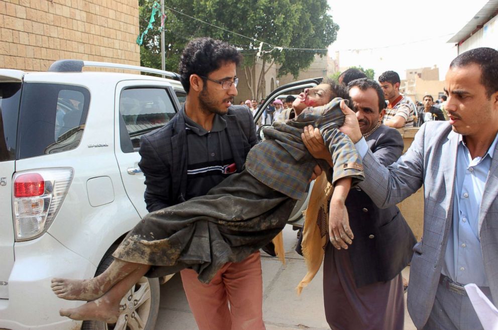 PHOTO: A Yemeni child is transported to a hospital after being being wounded in a reported air strike on the Iran-backed Huthi rebels' stronghold province of Saada, Aug. 9, 2018.