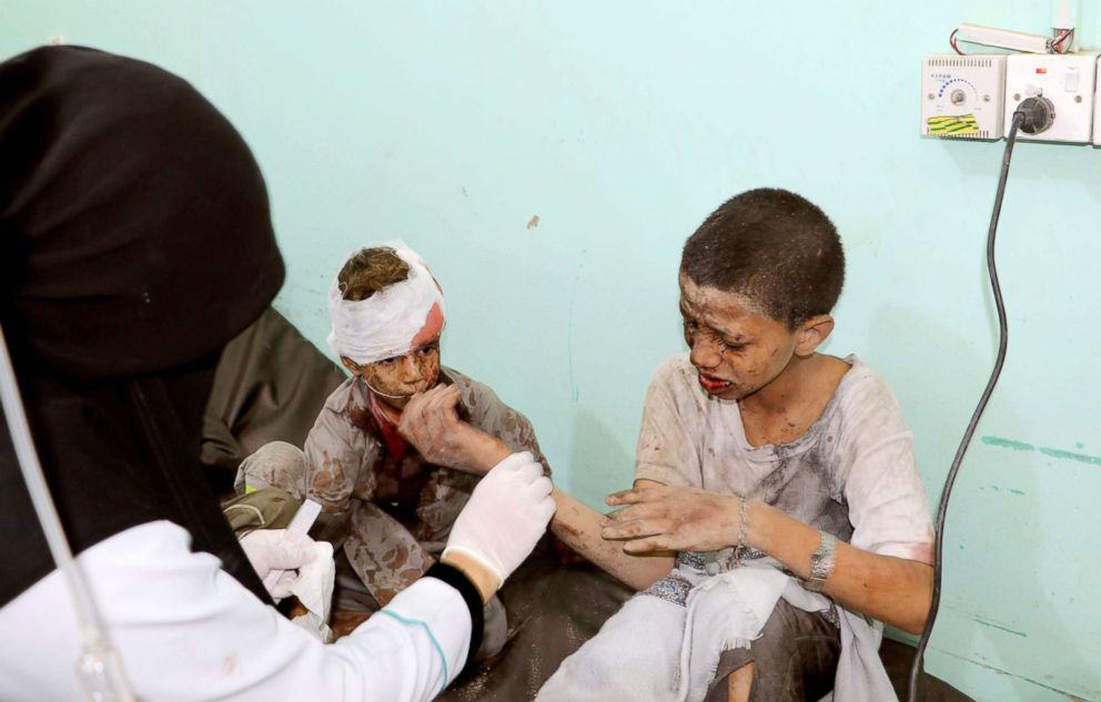 PHOTO: A doctor treats children injured by an airstrike in Saada, Yemen, Aug. 9, 2018.