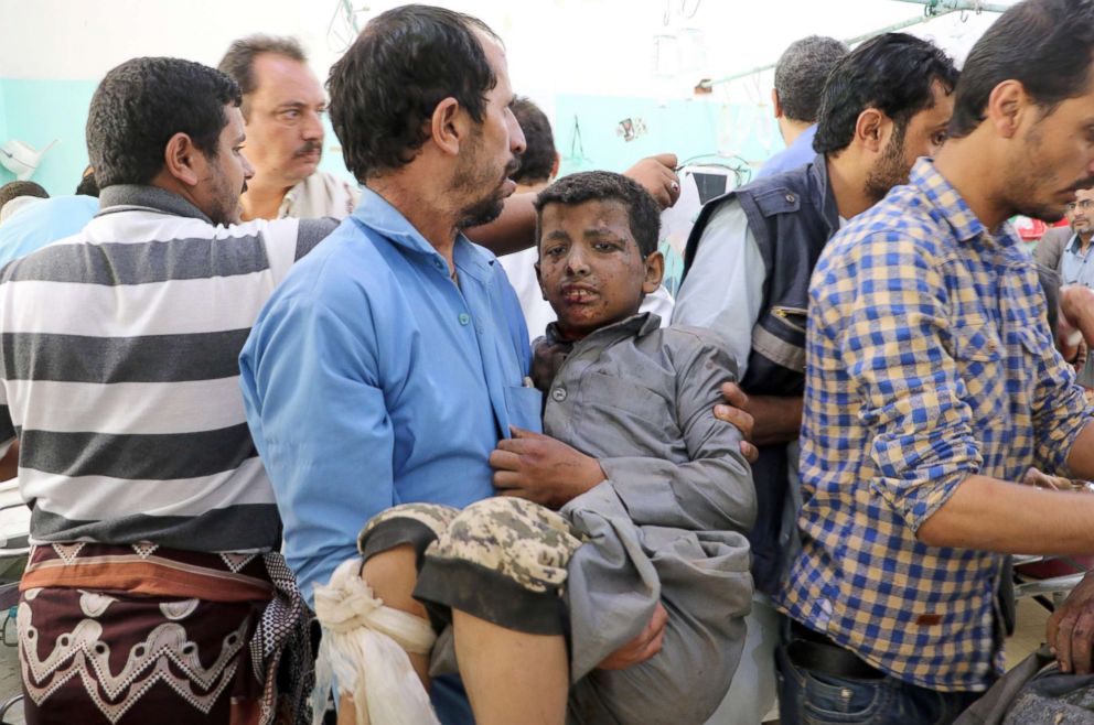 PHOTO: A Yemeni man holds a boy who was injured by an airstrike in Saada, Yemen, Aug. 9, 2018.