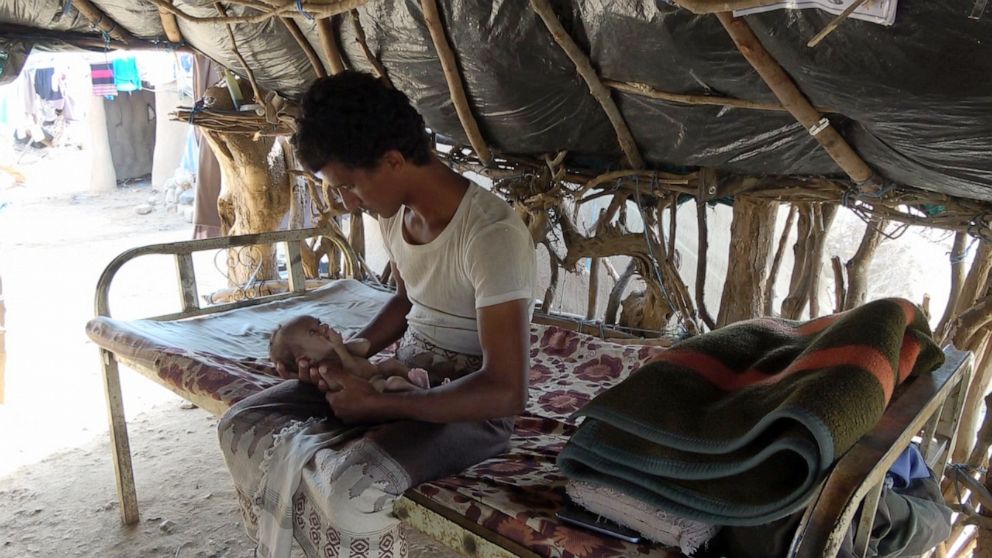 PHOTO: ALi Hussein Al-Kholani, Hussain's father, has no means of income, and relies on food handouts from the WFP to feed his family.