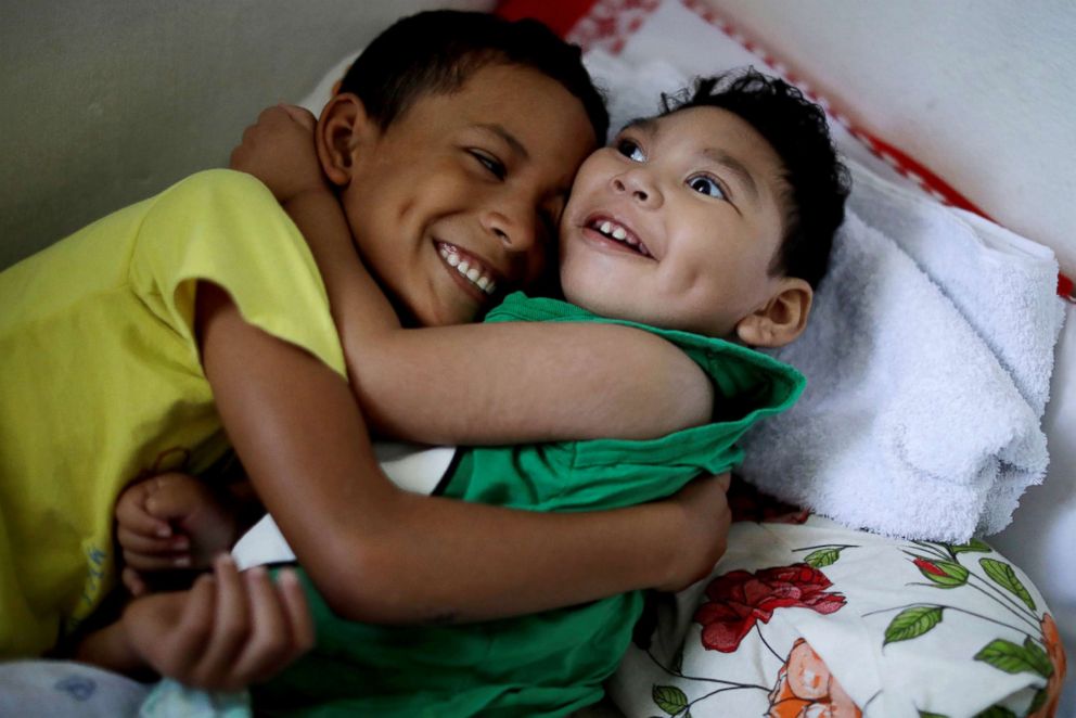 PHOTO: Daniel Vieira, who is two years old, and was born with microcephaly, is greeted by his brother at their house in Olinda, Brazil, Aug. 7, 2018.