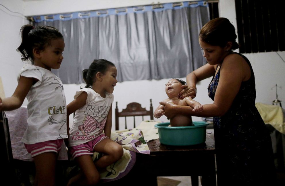 PHOTO: Gabriela Alves de Azevedo bathes her four-month-old daughter Ana Sophia, who was born with microcephaly, at their house in Olinda, Brazil, March 2, 2016.