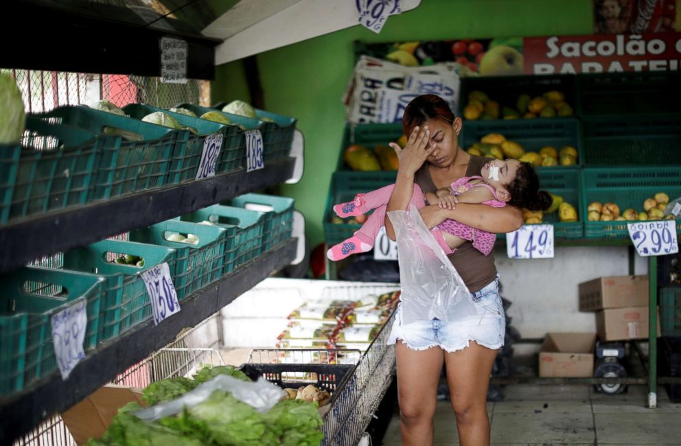 PHOTO: Rosana Vieira Alves, 28, holds her two-year-old, daughter Luana Vieira, who was born with microcephaly, at a supermarket in Olinda, Brazil, Aug. 9, 2018.