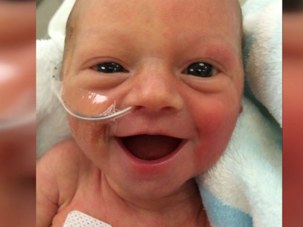 preemie child