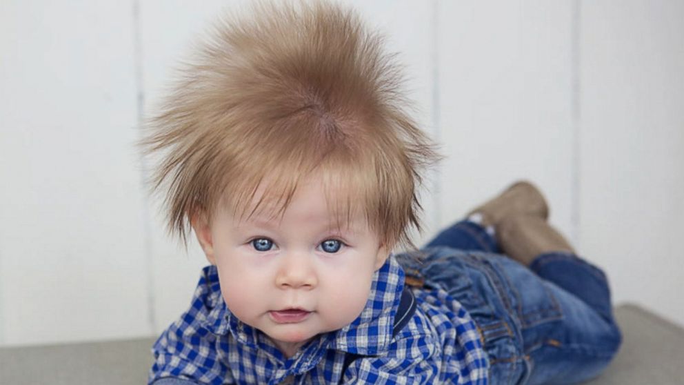 Baby boy's hair is so thick and lustrous it could be seen in the