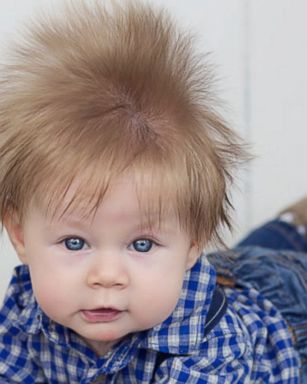 5-month-old baby boy's wild hair is the mane event - ABC News