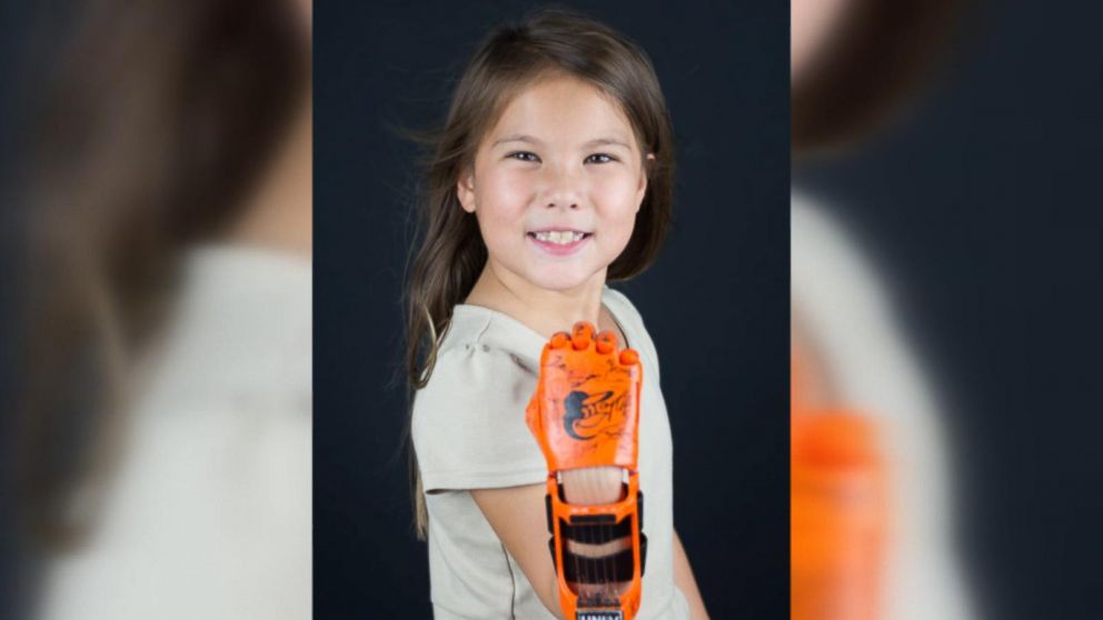 With help from prosthetic hand, Hailey Dawson continues first-pitch tour