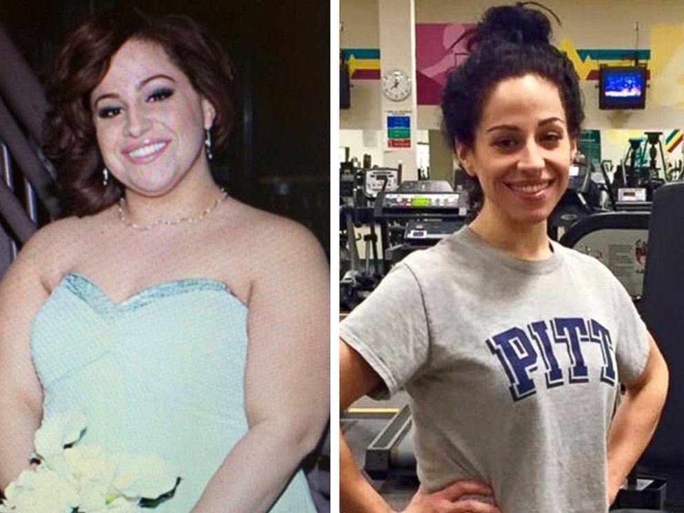 PHOTO: Andrea Massella appears before and after losing significant body weight.