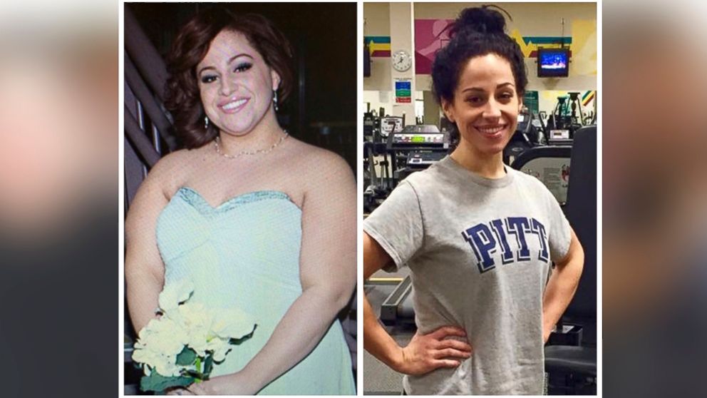 PHOTO: Andrea Massella appears before and after losing significant body weight.