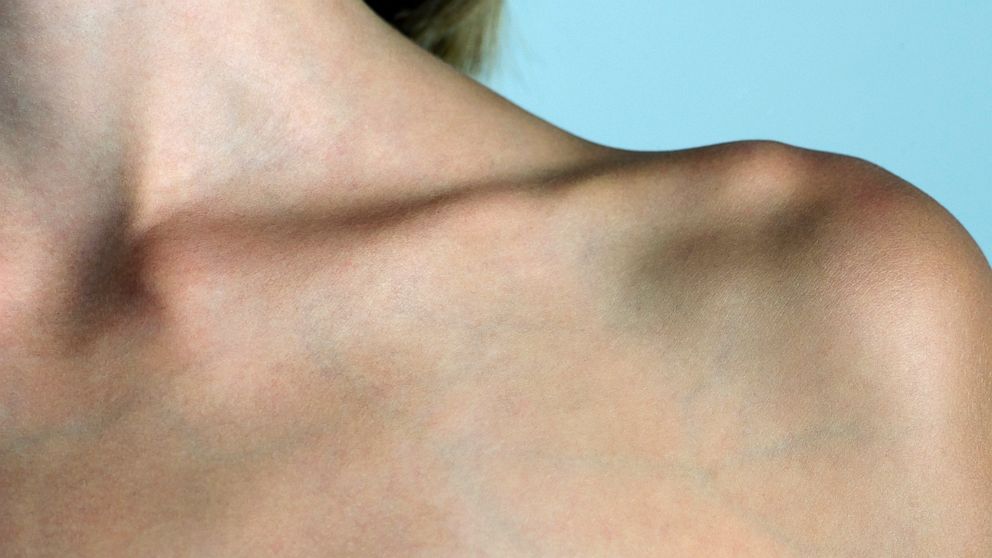 PHOTO: Fresh on the the heels of the belly button challenge comes another bizarre body trend out of China: the collarbone challenge.