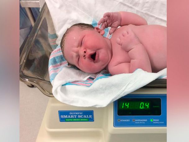 PHOTO: South Carolina parents Arthur Keisler and Cindy Richmond were shocked by their 14-pound newborn, Colin.