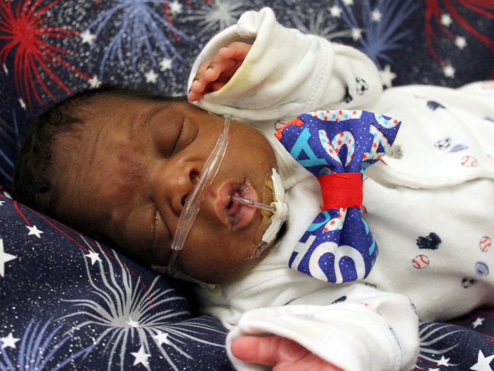 PHOTO: The preemies in the neonatal intensive care unit at the University of Cincinnati Medical Center wore red, white and blue to celebrate the 4th of July.