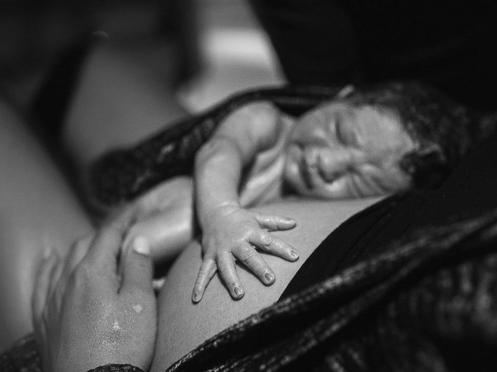 PHOTO: Lauren Strunk, 35, gave birth to her second child in a hospital parking lot with her husband, Noah Strunk, also 35, by her side.