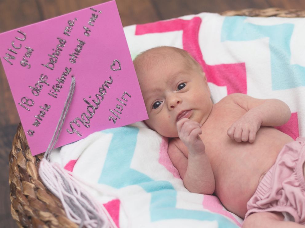 PHOTO: Baby Madison is celebrated the day she left the neonatal intensive care unit at CaroMont Health in Gastonia, North Carolina, on Feb. 15.