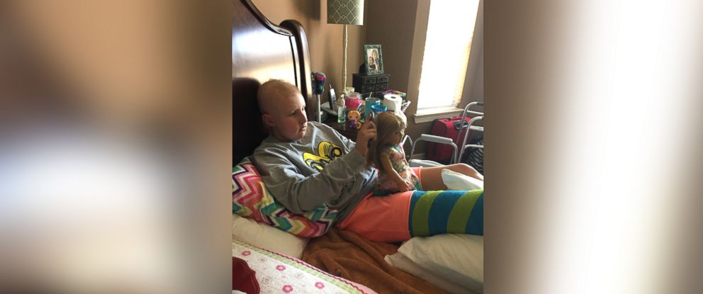 PHOTO: Dylan Probe, 10, received an American Girl doll with a prosthetic leg after having her own leg amputated due to cancer.