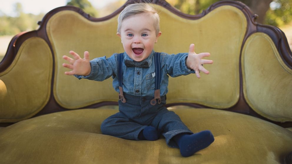 PHOTO: Asher Nash is 15-months-old and lives in Buford, Georgia. His mother was contacted by Osh Kosh B'Gosh after she identified the company as a brand that did not use children with disabilities in its advertising.