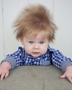 5monthold baby boys wild hair is the mane event  ABC News