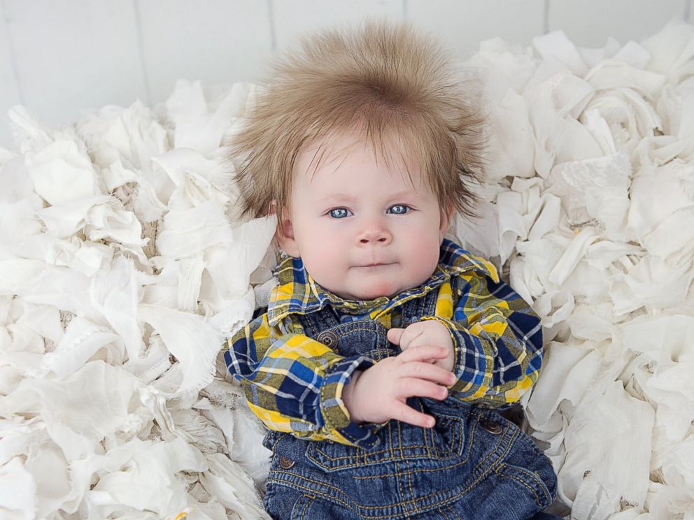 5-month-old baby boy's wild hair is the mane event - ABC News