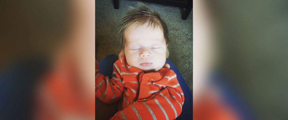 PHOTO: 5-month old Oliver Dunn, of Nampa, Idaho, has had a full head of hair since birth.