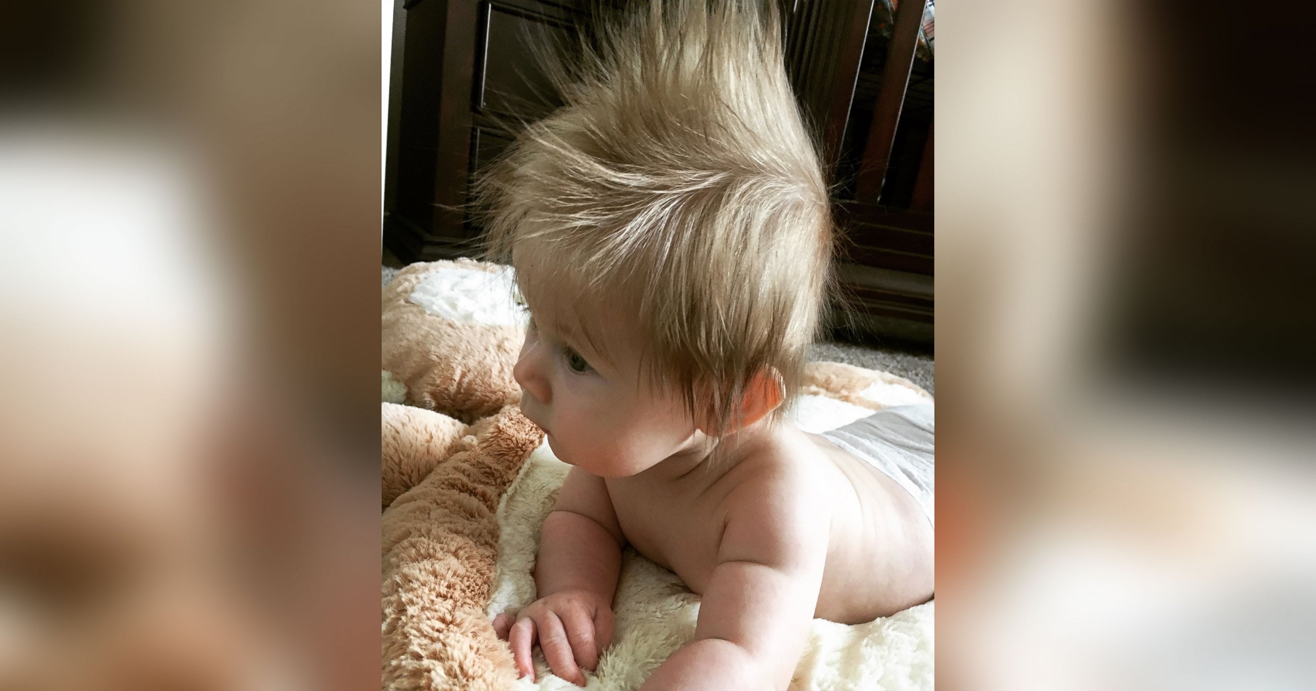 PHOTO: 5-month old Oliver Dunn, of Nampa, Idaho, has had a full head of hair since birth.