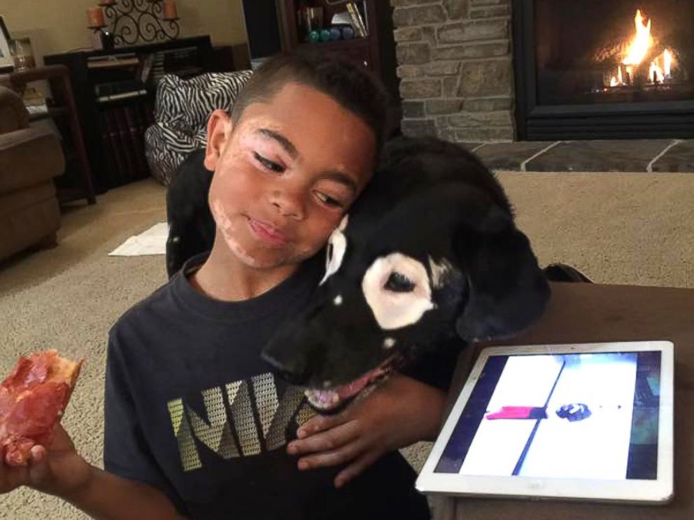 PHOTO: Carter Blanchard, 8, and Rowdy, a 13-year-old dog, both have a rare skin disorder called vitiligo.