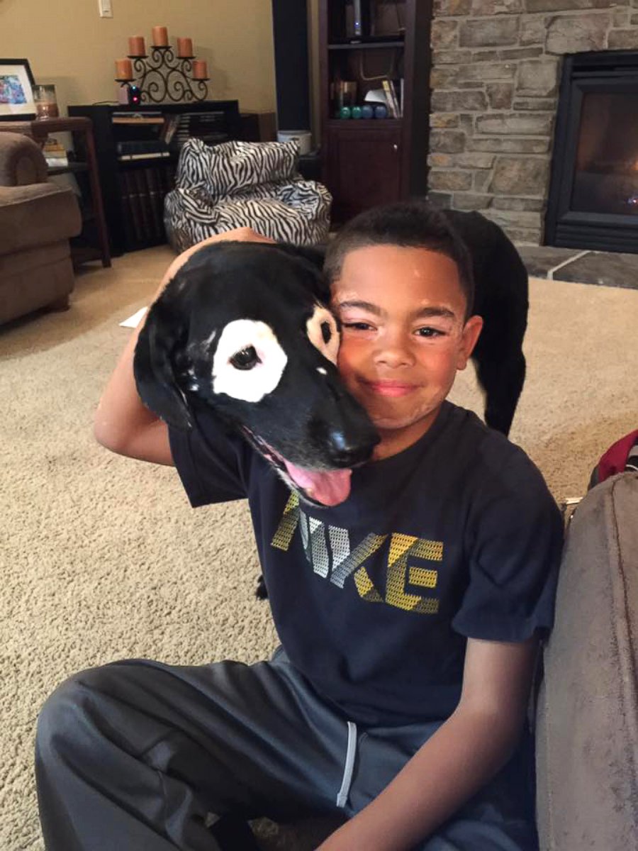 PHOTO: Carter Blanchard, 8, and Rowdy, a 13-year-old dog, both have a rare skin disorder called vitiligo.