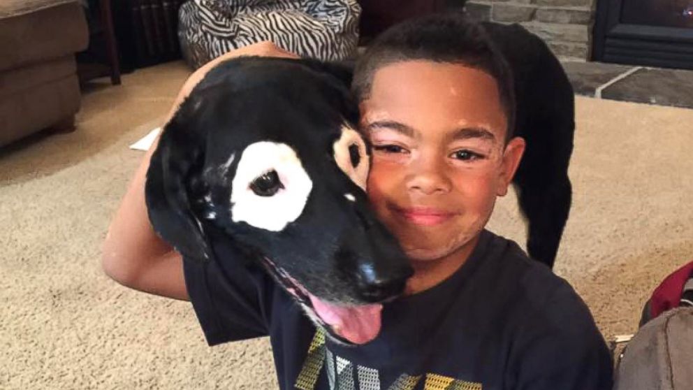 PHOTO: Carter Blanchard, 8, and Rowdy, a 13-year-old dog, both have a rare skin disorder called vitiligo.