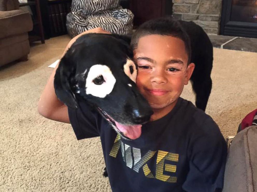PHOTO: Carter Blanchard, 8, and Rowdy, a 13-year-old dog, both have a rare skin disorder called vitiligo.