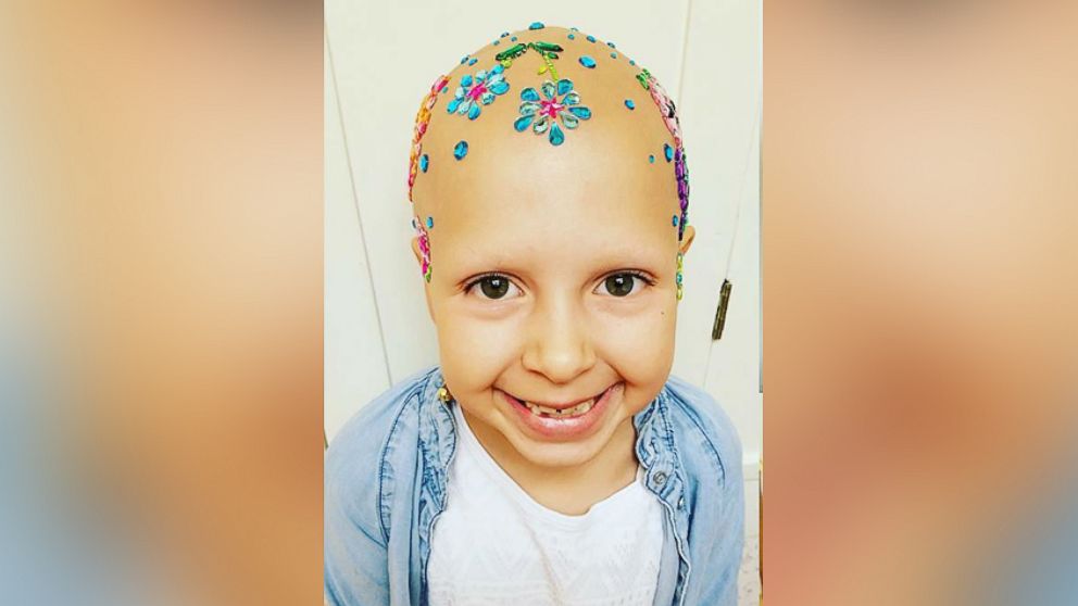 Gianessa Wride, 7, who was diagnosed with alopecia back in January, still participated in her elementary school's "Crazy Hair Day."