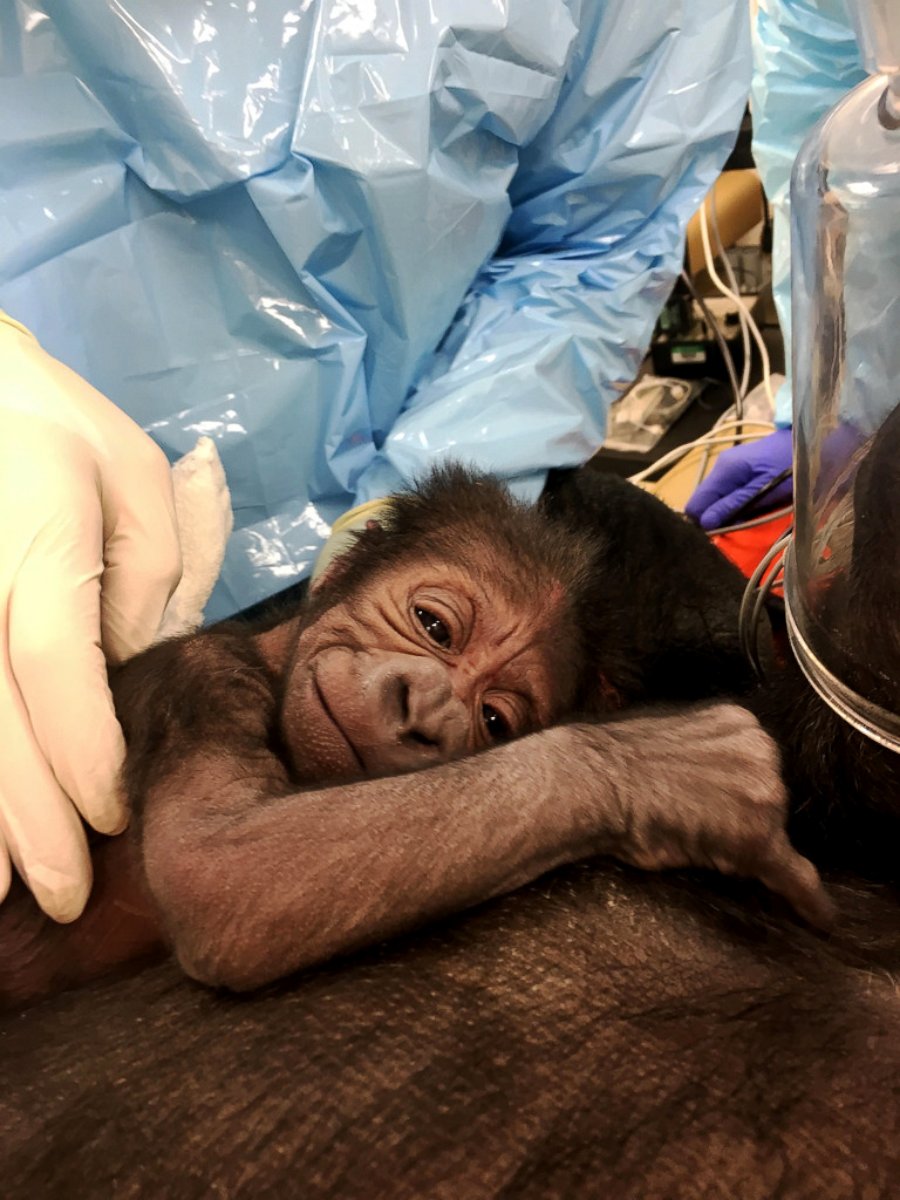 PHOTO: The Philadelphia Zoo brought in human OB-GYNs to help deliver this baby gorilla.