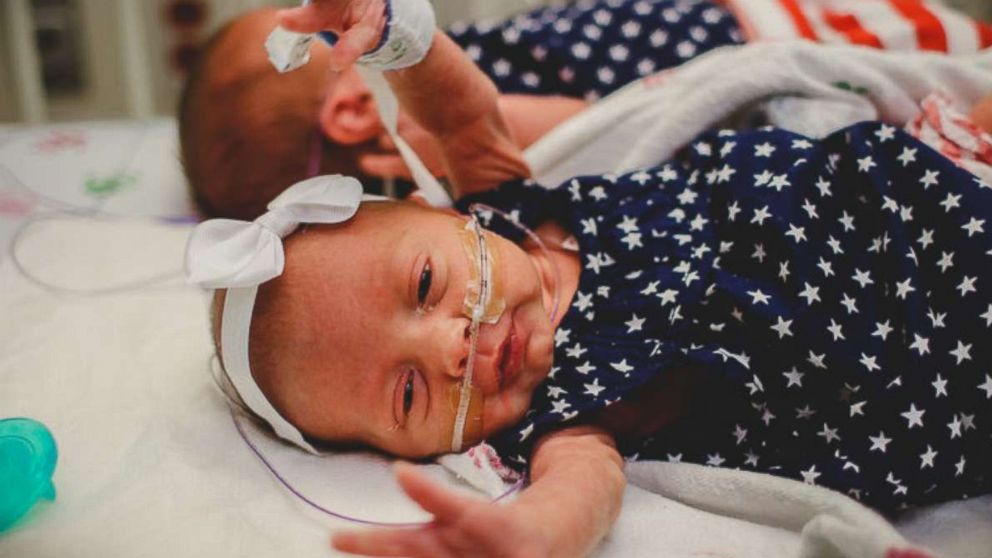 The neonatal intensive care unit at Advocate Children's Hospital in Chicago threw a Fourth of July celebration for its tiniest patients.