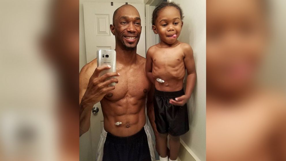 A photo of Robert Selby and his 3-year-old son Chase has gone viral, bringing awareness to Chase and congenital heart defects in children.