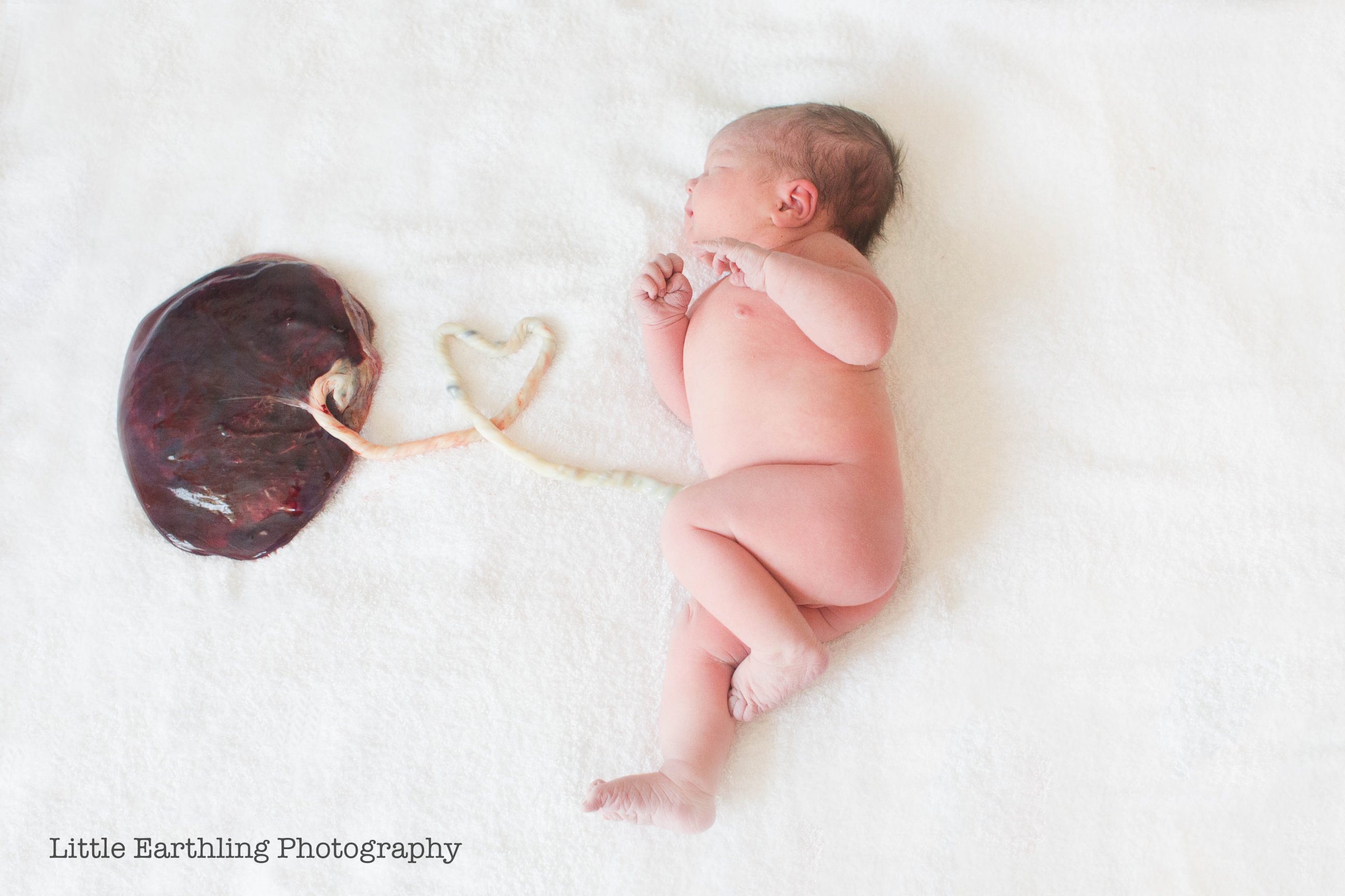 PHOTO: Photographing babies with their placenta still attached is a growing trend among new moms.
