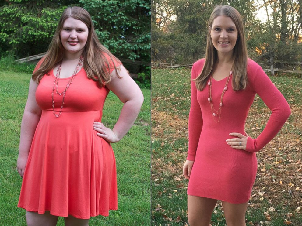 PHOTO: Rebecca Grafton is a 25-year-old saleswoman who lost 104 pounds after ballooning up to 246 pounds in college.