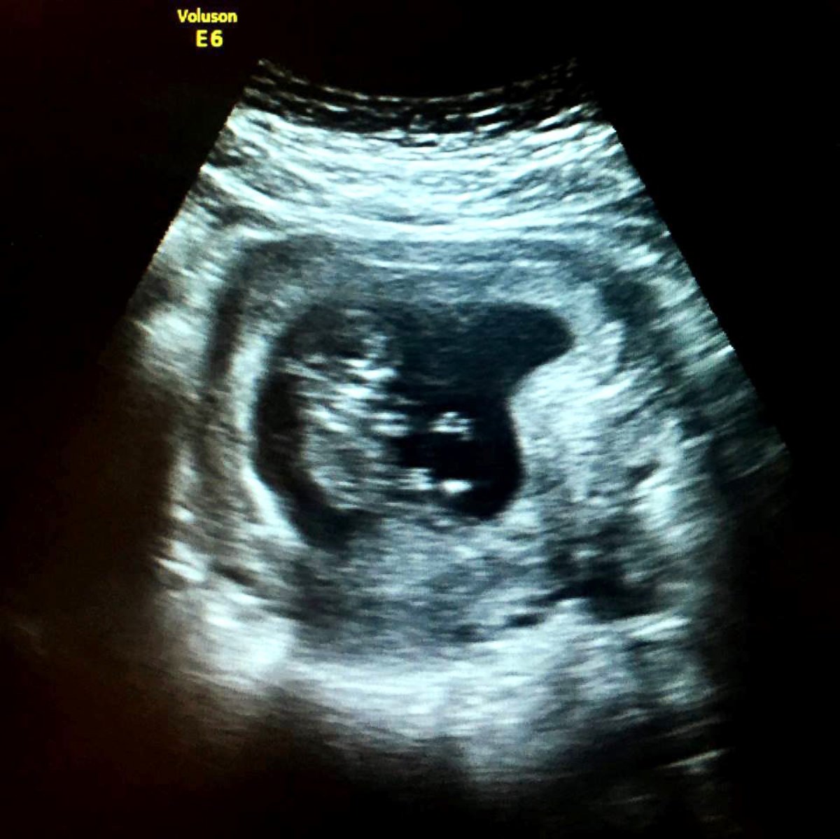 PHOTO: Dan Majesky shared an ultrasound of his first child with wife, Leah, on Facebook in a now viral post.