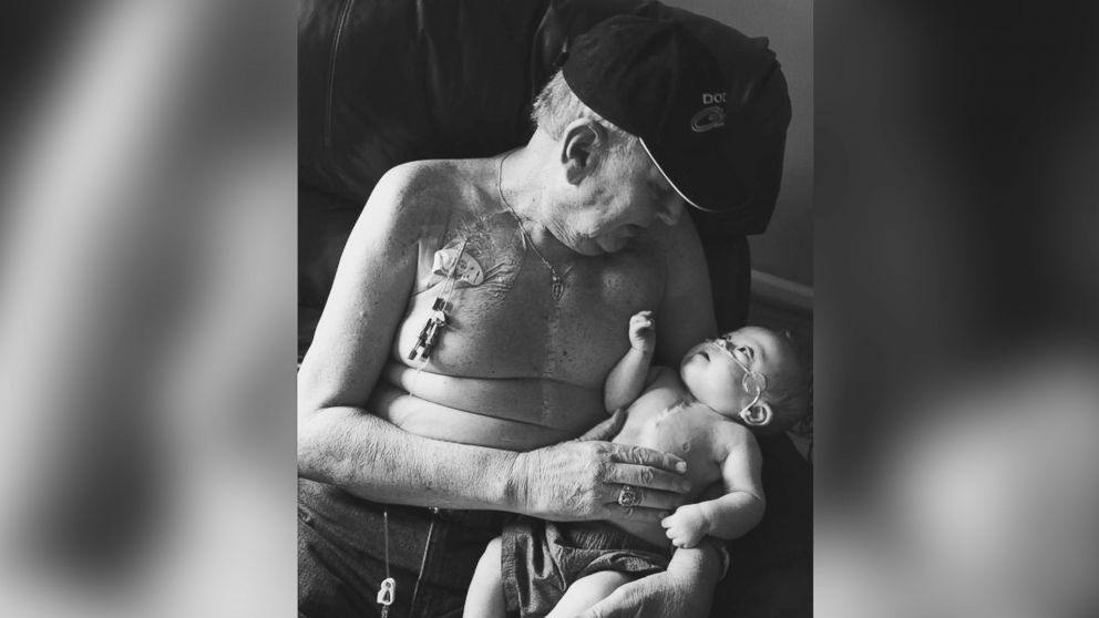 Grandfather Allan Halstead with his grandson Kolbie Gregware who both underwent open heart surgery are photographed together. 