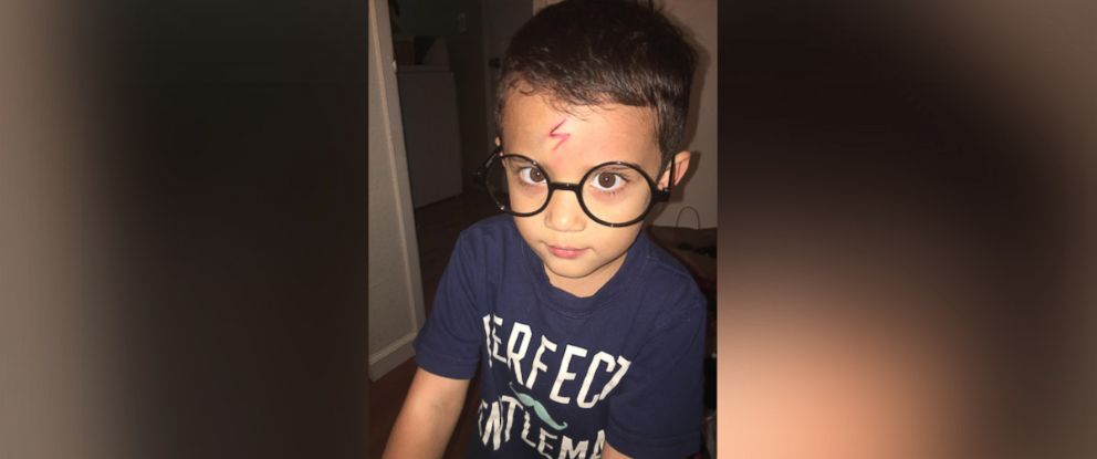 Mom Uses Son S Forehead Cut To Turn Him Into Harry Potter Abc News