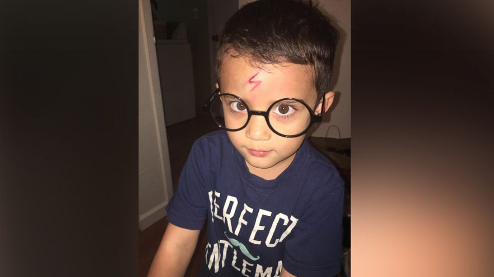 PHOTO: Little Ayden Benesh-Lastrella's mother Brittaney turned him into a miniature Harry Potter after he was embarrassed about his forehead scar.