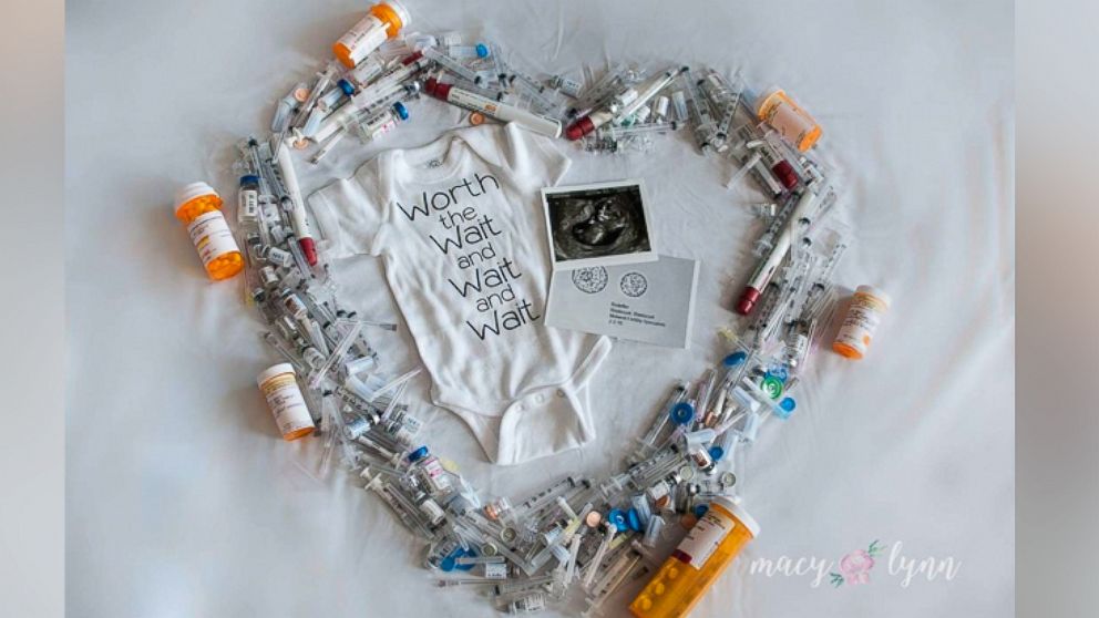 Macy Rodeffer hopes to inspire others through her IVF-themed pregnancy announcement. 