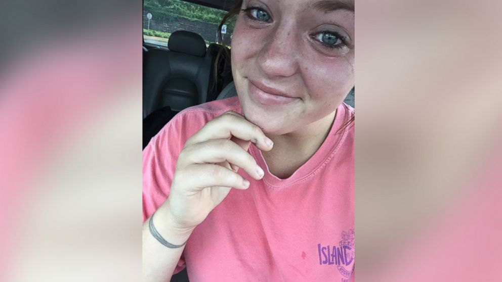 Allison Brothers' selfie, in which she's crying, has gone viral online, inspiring many parents in the process.