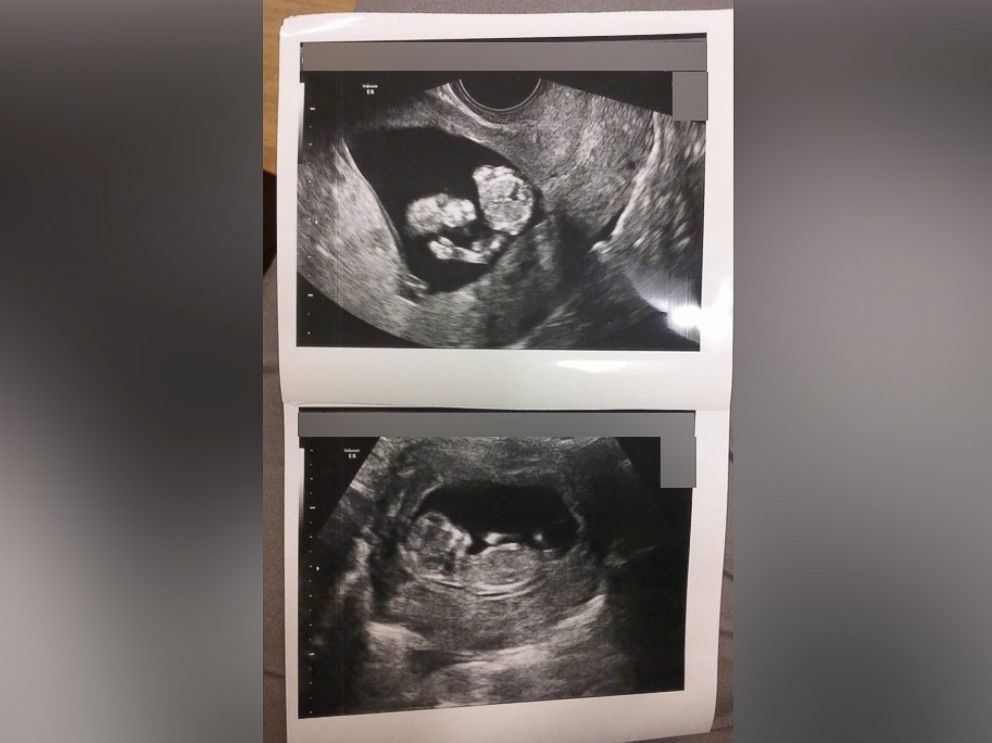 PHOTO: Mehgan Merriott and Robert Cooper of Columbus, Georgia said her baby appeared to be saluting to her and the baby's marine dad in a sonogram photo dated September 12.