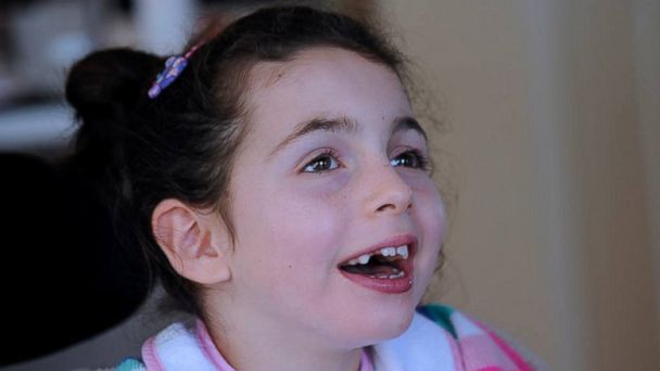 Child With Rare Disease That Reverses Development Hasn't Lost Her Smile 